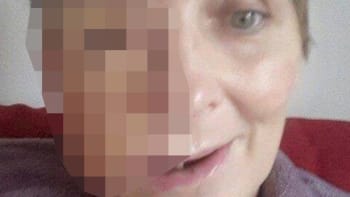 Matka čtyř dětí statečně ukázala na Facebooku tvář poté, co ji o ni připravila rakovina. Někteří si ji smazali z přátel!