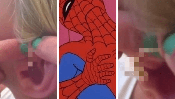 VIDEO PRO OTRLÉ: Jako Spider-Man! Šest let pěstovaný pupínek v uchu vydal své odporné tajemství