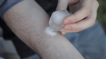 DRSNÉ VIDEO: Nová brutální výzva! Lidé si pokládají led na posolenou kůži. Proč si dobrovolně ubližují?