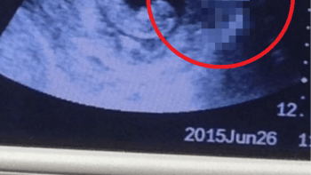 FOTO: Porodí žena satana? Na ultrazvuku se budoucí mámě objevil děsivý přízrak!