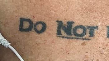 FOTO: Doktoři chtěli operovat, pak si ale všimli varovného tetování! Co měl muž vytetovaného na hrudi?