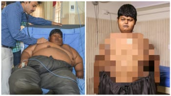Tenhle chlapec zhubl přes 40 kilo za pouhé 3 měsíce! Dokázal to jen díky lidské dobrotě...