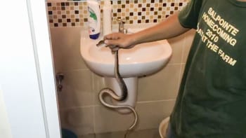 GALERIE: Týpek seděl na záchodě a do penisu se mu zakousl had! Z těchto snímků vám nebude dobře