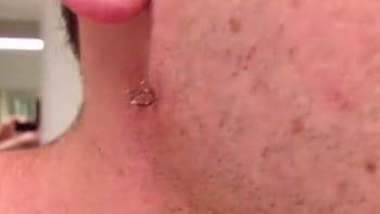 VIDEO: Muž se holil, když na své tváři našel něco velmi nechutného. Tohle se může stát i vám!