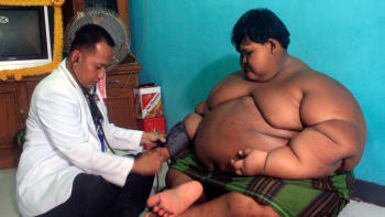 GALERIE: Nejtlustší chlapec světa zhubl více než polovinu své původní váhy. Kolik má teď?