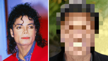 ŠÍLENÉ FOTO: Tohle s vámi udělá plastická chirurgie! Takhle by vypadal Michael Jackson bez operací…