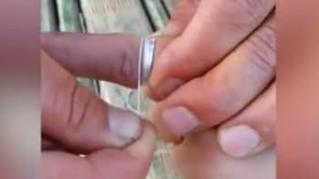 VIDEO: Uvízl vám na ruce prsten? Tohle je jednoduchý způsob, jak ho dostat ven