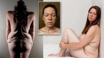 ŠOKUJÍCÍ FOTO! Žena ukázala své tělo poté, co zhubla 70 kilo!