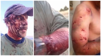 VIDEO: Děsivé záběry, které otřásly internetem! Muž byl napaden obřím grizzlym! Podívejte se na jeho zranění!