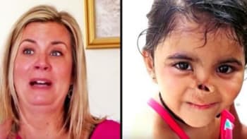 Žena adoptovala holčičku bez nosu. Během 3 let prošla touhle ohromnou proměnou!