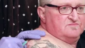 VIDEO: Muž měl na zádech desítky let obří cystu. Její vymačkávání prověří odolnost vašeho žaludku
