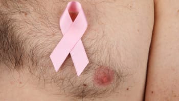 SMUTNÝ PŘÍBĚH: Muž s rakovinou prsu odhalil moment, kdy si uvědomil, že je nemocný. Tohle vás rozpláče!
