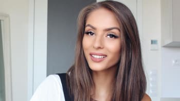 FOTO: Zcela nová Týnuš! Popálená youtuberka po 8 měsících konečně ukázala celou tvář. Jak se změnila?