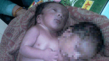 FOTO: V Indii se narodilo DVOUHLAVÉ dítě! Jaká byla reakce matky po porodu?