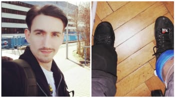 FOTO: Youtuber Martin Rota poprvé ukázal svou náhradní nohu. Způsobuje mu ale nečekaný problém…