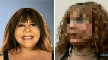 GALERIE: Transsexuálce se roztekl obličej po nelegální plastické operaci! Do tváří jí dali beton!