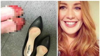 FOTO: Lidé jsou v šoku ze zkrvavených nohou servírky. Její zaměstnavatel ji nutí nosit celý den podpatky!