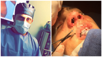 FOTO: Takhle vypadá řezničina při práci plastického chirurga! Doktor zveřejňuje fotky z operací!