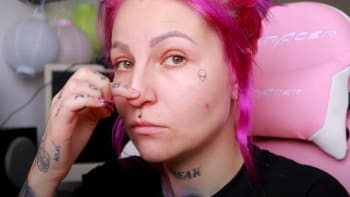 VIDEO: Slovenská youtuberka šla na plastickou operaci nosu! Vypadá teď lépe než předtím?