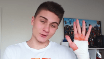 VIDEO: Šok! Youtuber Datel skončil v nemocnici kvůli vážnému zranění ruky. Co se mu stalo?