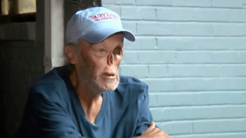 VIDEO: Muže, který přežil rakovinu kůže, vyhodili z benzínky! Z jejich důvodu se vám udělá špatně