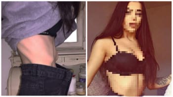 FOTO: Anorektička se změnila v zatraceně SEXY krásku! Podívejte se, proč začít pořádně jíst