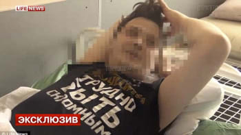 Moderátor ruské televize se probudil s děsivým zjištěním, byl vykastrován