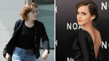 FOTO: Poznali byste Hermionu? Takhle pobledle Emma Watson vypadá bez make-upu! To by porazilo i Voldemorta