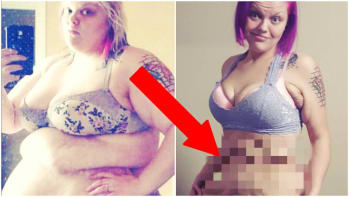 Dívka zhubla neuvěřitelných 85 kilo! Sexy postavu jí ale kazí tahle nechutnost!