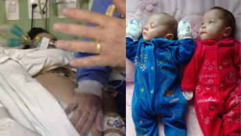 PŘÍBĚH: Ženu udržovali lékaři naživu 4 měsíce, aby zachránili její ještě nenarozená dvojčata!