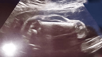 FOTO: Nastávající máma šla na ultrazvuk. Otec dítěte si všiml, že miminko má tvar AUTA! Vidíte to také?
