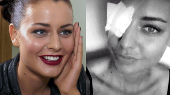 Kam zmizelo oko modelky Chlebovské? (TOP STAR video)