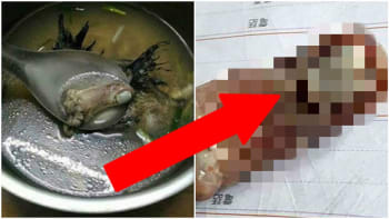FOTO: Žena našla v polévce lidský prst! Neuvěříte, jak se tam vzal!