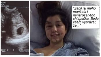 FOTO: Opilý mladík jí při autonehodě zabil manžela i nenarozené dítě. Z nemocnice mu poslala tenhle drsný vzkaz!