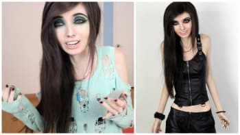 GALERIE: Svět se bouří proti vyhublé youtuberce! Lidé chtějí kvůli její anorexii zrušit její kanál. Neuvěříte, jak se brání!