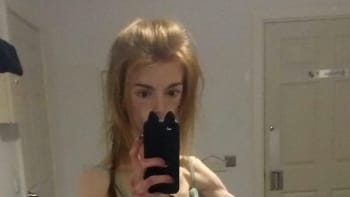 GALERIE: Dívka porazila anorexii tím, že jedla čokoládu! Z vyhublé zombie se proměnila v sexy krásku