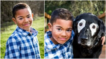 DOJÁK: Chlapec kvůli nemoci kůže nesnášel svůj obličej. Zázračně mu pomohl tento vzácný pes!