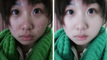 GALERIE: Z ošklivky modelkou! Čínské holky podlehly appce, která to dokáže. Porovnejte fotky před a po…