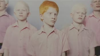 Slepí albíni a další šoky: World Press Photo opět v Praze!