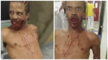 DĚSIVÉ VIDEO: Tyhle záběry ukazují posedlého muže v nemocnici poté, co byl postřelen do obličeje!
