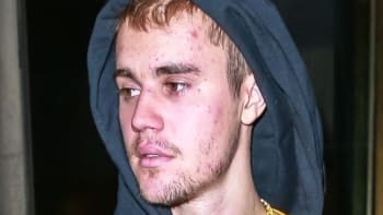 GALERIE: Justin Bieber šokoval svět a přiznal se k vážné nemoci! Kvůli čemu si lidé mysleli, že je na drogách?