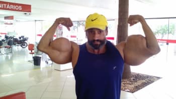 Ve věku 55 let zemřel brazilský Hulk. Kulturista byl závislý na vpichování oleje do svalů