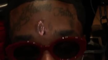 Slavný rapper si nechal odstranit diamant z čela! Jaký závažný důvod k tomu měl?