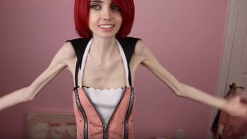 GALERIE: Nejvyzáblejší youtuberka světa konečně přiznala, že je anorektička a hledá pomoc! Vážně jí to došlo až teď?