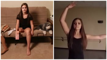 VIDEO: Dívka s rakovinou a po amputaci nohy žije jen pro tanec. Po neuvěřitelné operaci bude zase baletkou!