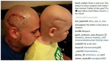FOTO: Dojemná fotka dobývá internet! Otec si nechal vytetovat jizvu podle svého syna s rakovinou!