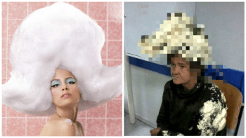 NEUVĚŘITELNÉ FOTO: Žena použila místo šamponu montážní pěnu, doktoři nevěřili svým očím!