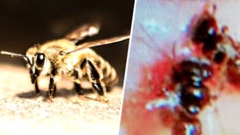 VIDEO: Doktor objevil čtyři včely v oku jedné nebohé ženy. Krmily se jejími slzami. Z toho se vám udělá špatně