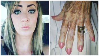 Žena pracuje v pečovatelském domě. Tam vyfotila ruku jedné důchodkyně a její fotka se stala virálním hitem! Proč?