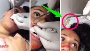 Šokující video! Lékař odstranil dívce ze rtu obrovského červa o velikosti žížaly